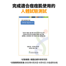 將圖片載入圖庫檢視器 KOCOSTAR 隱形液體痘痘貼+棉花棒50支