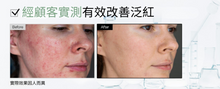 將圖片載入圖庫檢視器 IVOSKIN 積雪草深層修護霜
